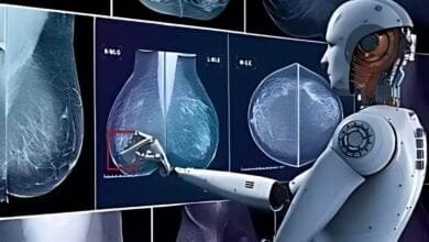 AI Breakthroughs in Breast Cancer