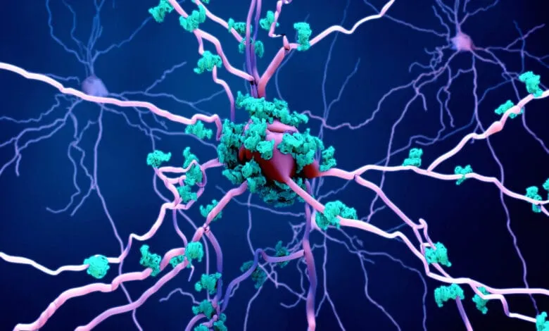 3D illustration of neurons in the aging brain, showing protein deposits accumulating on the neuron's branches.