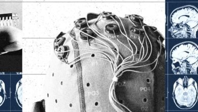 Brain-computer interface device with wires and sensors attached to a head model, alongside MRI brain scans.