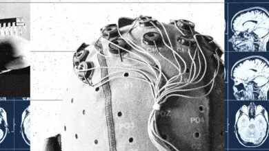 China’s Brain-Computer Interface Industry Is Taking Off