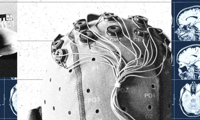 Brain-computer interface device with wires and sensors attached to a head model, alongside MRI brain scans.