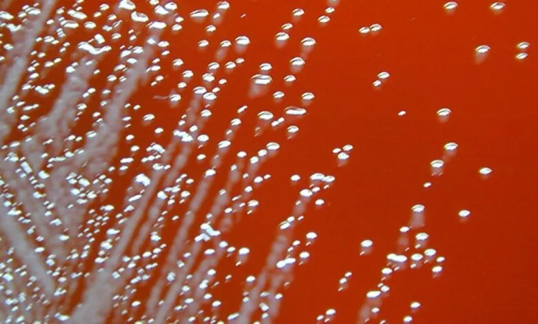 Microscopic view of bacterial colonies on an orange agar plate, showing white colonies and gas bubbles.