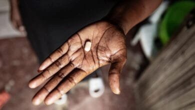 5 Kids Achieve Undetectable HIV Levels With Antiretroviral Therapy