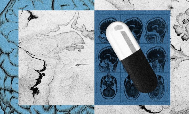 A large pill rests on MRI brain scans, juxtaposed with vintage brain anatomy illustrations. Explores themes of mental health and medicine.