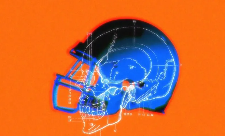 Football helmet superimposed over a blue anatomical skull diagram with impact points.