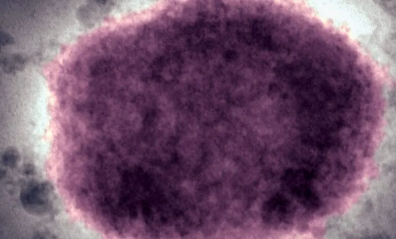 Microscopic view of a purple cell with a textured surface against a blurred background.