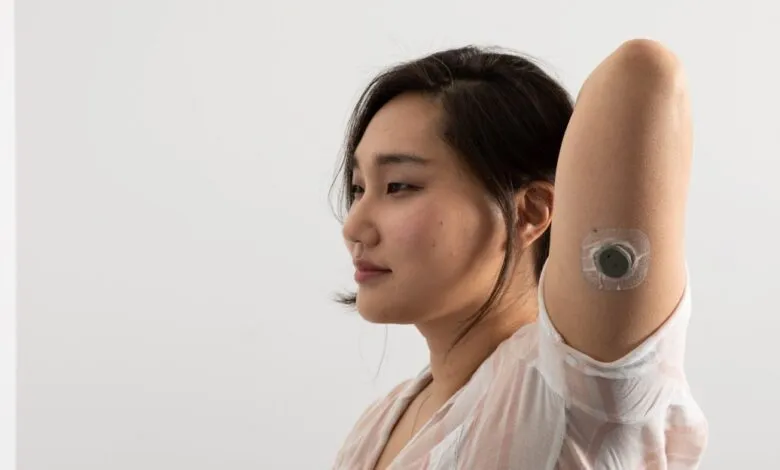 Woman with Dexcom CGM sensor on upper arm, side profile.