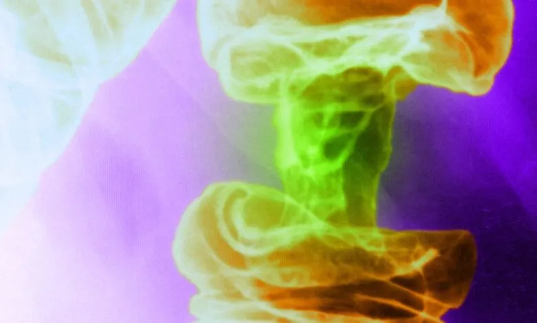 Abstract image of a mushroom cloud in vibrant green, orange, and purple hues.
