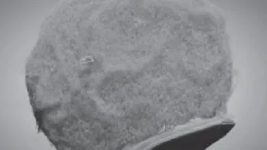 Tiny Chips Ride Immune Cells to Fight Inflammation