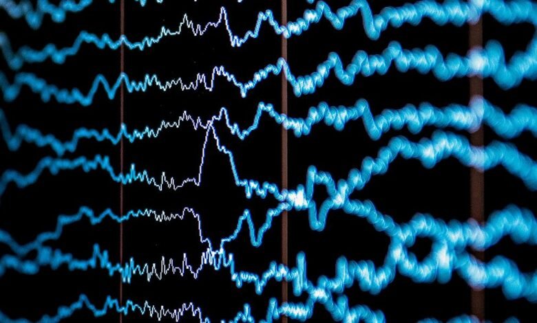 Abstract display of multiple blue wavy lines on a black background, resembling brainwave patterns.