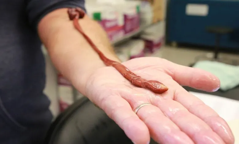 A ribbon worm stretches across a person's open, wet palm.