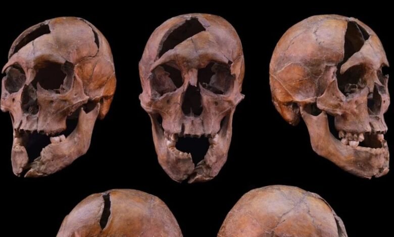 Three human skulls with damage displayed against a black background.