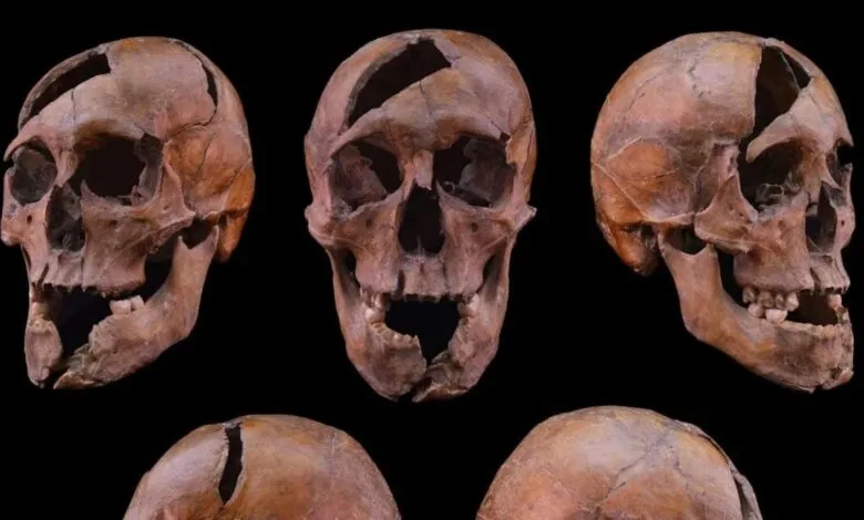 Three human skulls with damage displayed against a black background.