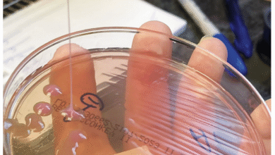Petri dish with bacterial colonies being streaked with a loop.
