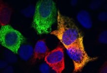 Fluorescent microscope image of cells with stained endoplasmic reticulum.