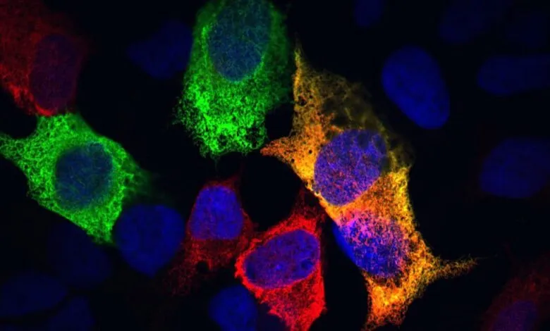 Fluorescent microscope image of cells with stained endoplasmic reticulum.