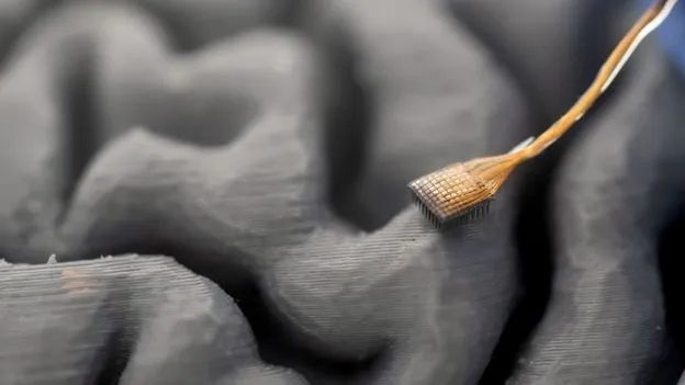 Neural implant on a 3D printed brain model for research.
