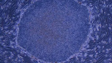 Japan OKs First-Ever Treatment Using Reprogrammed Human Cells