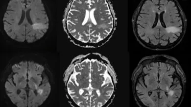 The Hidden Brain Virus You May Already Have