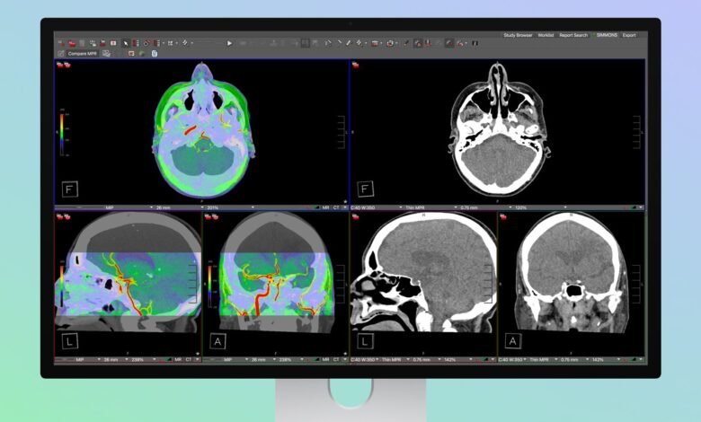 Medical imaging software displaying CT scans of a human head.