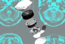 Neuralink device components displayed over brain scan images.