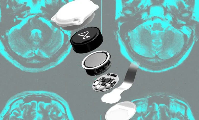 Neuralink device components displayed over brain scan images.