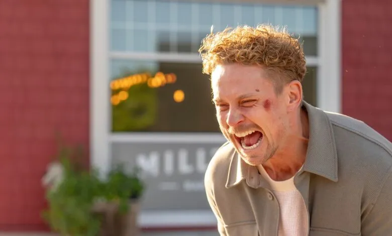 Man with a bruise on his face is laughing outdoors.