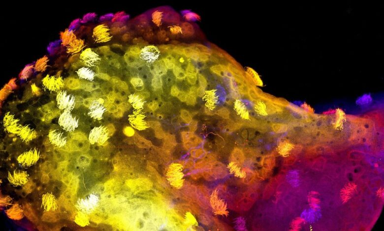 Microscopic view of cells with cilia, vibrant yellow, orange, and purple hues.
