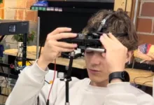 Person wearing a device on their head, possibly for research or medical purposes.