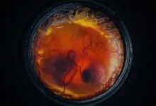 Close-up view of a developing embryo inside a dark, circular frame.