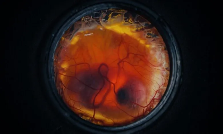 Close-up view of a developing embryo inside a dark, circular frame.