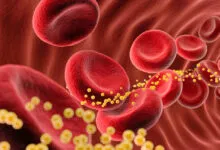 3D rendering of red blood cells with cholesterol deposits in a blood vessel.