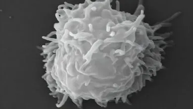 Scanning electron microscope image of Acanthamoeba polyphaga with pseudopodia.