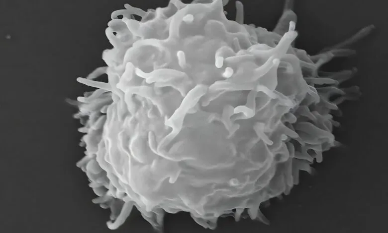 Scanning electron microscope image of Acanthamoeba polyphaga with pseudopodia.