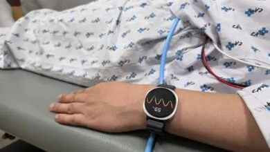 Person's arm with smartwatch displaying heart rhythm and 59% reading.