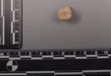 Extracted human molar tooth on a gray surface with measurement scales.