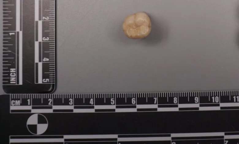 Extracted human molar tooth on a gray surface with measurement scales.