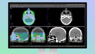 Apple's Studio Display Now Supports Medical Imaging for Radiology