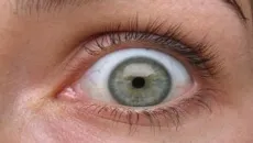 Man's eyeball massage with gun ends predictably in injury
