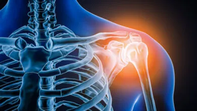 Doctors probing man’s shoulder pain find the joint is missing