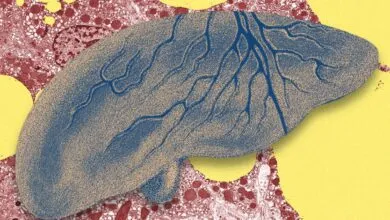 AI Could Help Curb the Fatty Liver Epidemic