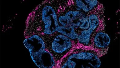 Microscopy image of a 2D organoid slice showing grey nuclei, pink smooth muscle, and blue epithelium.